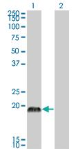 Anti-CSRP3 Mouse Monoclonal Antibody [clone: 6D2]