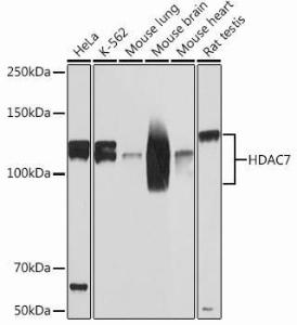 Western blot analysis of extracts of various cell lines, using Anti-HDAC7 Antibody [ARC0713] (A308515) at 1:1000 dilution. The secondary Antibody was Goat Anti-Rabbit IgG H&L Antibody (HRP) at 1:10000 dilution. Lysates/proteins were present at 25 µg per lane