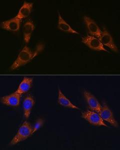 Immunofluorescence analysis of NIH-3T3 cells using Anti-gamma Catenin Antibody [ARC0909] (A305834) at a dilution of 1:100 (40x lens) DAPI was used to stain the cell nuclei (blue)