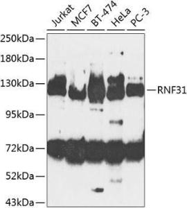 Western blot analysis of extracts of various cell lines, using Anti-RNF31/HOIP Antibody (A10351) at 1:1,000 dilution The secondary antibody was Goat Anti-Rabbit IgG H&L Antibody (HRP) at 1:10,000 dilution Lysates/proteins were present at 25 µg per lane