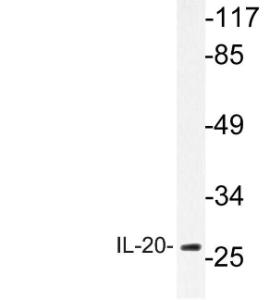 Western blot analysis of lysate from A549 cells using Anti-IL-20 Antibody