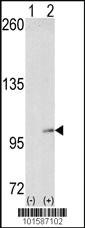 Anti-EPHA4 Rabbit Polyclonal Antibody