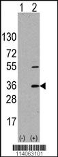 Anti-SSR1 Rabbit Polyclonal Antibody