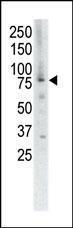 Anti-MUSK Rabbit Polyclonal Antibody (PE (Phycoerythrin))