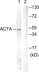 Antibody anti-actin-pan A94548-100 100 µg