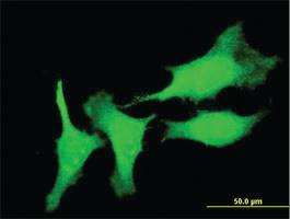 Anti-CSRP3 Mouse Monoclonal Antibody [clone: 6D2]