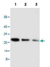 Anti-CDC42 Rabbit Polyclonal Antibody