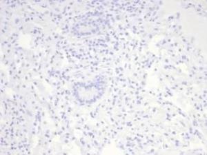 Anti-Nucleolin Rabbit Recombinant Antibody [clone: NCL/7014R]