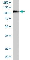 Anti-SART1 Goat Polyclonal Antibody