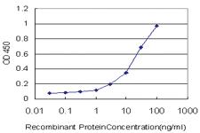 Anti-SHH Mouse Monoclonal Antibody [clone: 1B11]