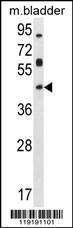 Anti-HOXD13 Rabbit Polyclonal Antibody (HRP (Horseradish Peroxidase))