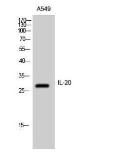 Western blot analysis of A549 cells using Anti-IL-20 Antibody