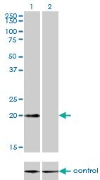 Anti-CSRP3 Mouse Monoclonal Antibody [clone: 6D2]