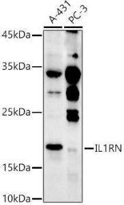 Western blot analysis of extracts of various cell lines, using Anti-IL-1RA Antibody (A308517) at 1:500 dilution. The secondary antibody was Goat Anti-Rabbit IgG H&L Antibody (HRP) at 1:10,000 dilution.