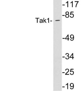 Western blot analysis of lysates from Jurkat cells using Anti-Tak1 Antibody