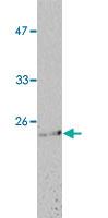 Anti-PRDX6 Mouse Monoclonal Antibody [clone: 52]