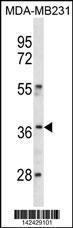 Anti-HOXC10 Rabbit Polyclonal Antibody (AP (Alkaline Phosphatase))