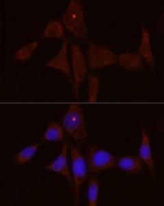 Immunofluorescence analysis of NIH/3T3 cells using Anti-IL-1RA Antibody (A308517) at a dilution of 1:50 (40x lens). DAPI was used to stain the cell nuclei (blue).