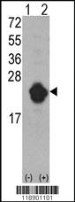 Anti-IL1RN Rabbit Polyclonal Antibody