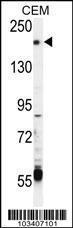 Anti-TRPM6 Rabbit Polyclonal Antibody (AP (Alkaline Phosphatase))