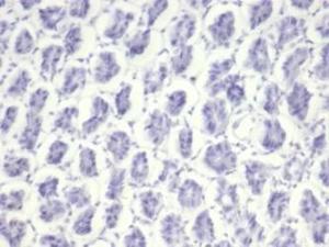 Anti-Nucleolin Rabbit Recombinant Antibody [clone: NCL/7014R]