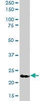 Anti-UBE2K Goat Polyclonal Antibody