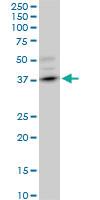 Anti-DMC1 Mouse Monoclonal Antibody [clone: 4A10]