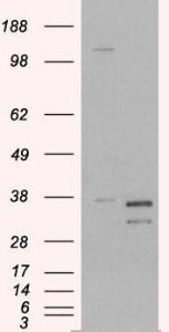 HEK293 overexpressing PIR (RC223111) and probed with Anti-PIR Antibody (A82451) (mock transfection in first lane), tested by Origene