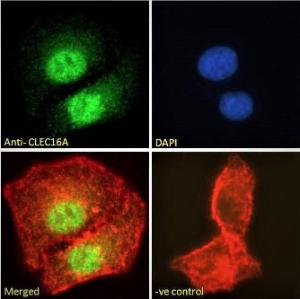 Anti-CLEC16A Antibody (A121152) - Immunofluorescence analysis of paraformaldehyde fixed A549 cells, permeabilized with 0.15% Triton