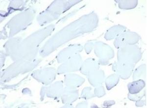 Anti-Nucleolin Rabbit Recombinant Antibody [clone: NCL/7014R]