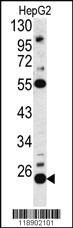 Anti-IL1RN Rabbit Polyclonal Antibody