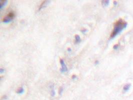 Anti-IAPP Rabbit Polyclonal Antibody