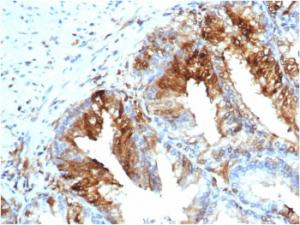 Anti-FABP5 antibody