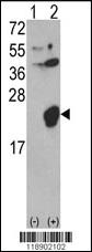 Anti-IL1RN Rabbit Polyclonal Antibody