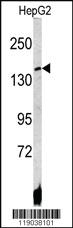 Anti-LZTS1 Rabbit Polyclonal Antibody