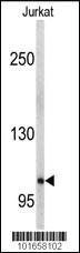 Anti-EPHA5 Rabbit Polyclonal Antibody