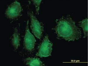 Anti-TAB1 Mouse Monoclonal Antibody [clone: 2A12]