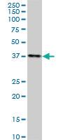 Anti-DMC1 Mouse Monoclonal Antibody [clone: 4A10]