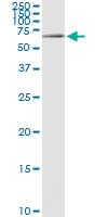 Anti-CACNB3 Polyclonal Antibody Pair