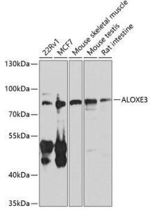 Western blot analysis of extracts of various cell lines, using Anti-e-LOX-3 Antibody (A10362) at 1:1,000 dilution