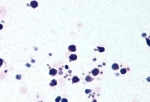 Anti-NLRP3 Antibody (A82453) (5µg/ml) staining of paraffin embedded Human Peripheral Blood Leukocytes. Steamed antigen retrieval with citrate buffer pH 6, AP-staining.