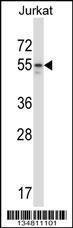 Anti-MAP2K7 Rabbit Polyclonal Antibody (HRP (Horseradish Peroxidase))