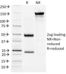 Anti-TSH Receptor antibody