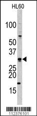 Anti-TTC6 Rabbit Polyclonal Antibody