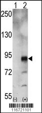 Anti-EPHA5 Rabbit Polyclonal Antibody