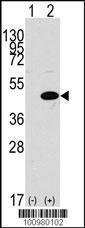 Anti-MAPK3 Rabbit Polyclonal Antibody (AP (Alkaline Phosphatase))