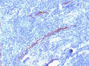 Immunohistochemical analysis of formalin-fixed, paraffin-embedded human tonsil using Anti-CD34 Antibody [HPCA1/1806R]