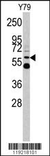 Anti-UDB17 Rabbit Polyclonal Antibody