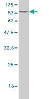 Anti-TRIP13 Mouse Monoclonal Antibody [clone: 3A5]