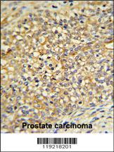 Anti-UDB17 Rabbit Polyclonal Antibody